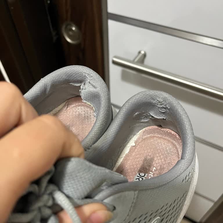 A101 Skechers Spor Ayakkabı 2 Ayda Parçalandı!