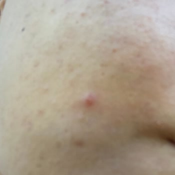 New Well Pınk Sun Cream Cildimi Mahvetti