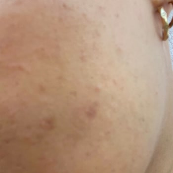 New Well Pınk Sun Cream Cildimi Mahvetti