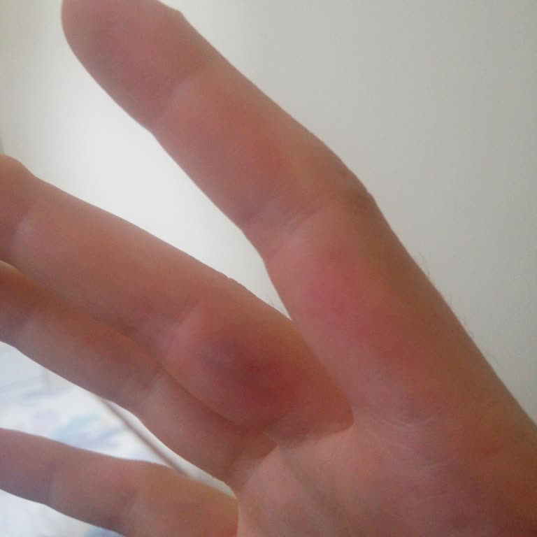 Philips Ev Aletleri Süpürge Şikayetim