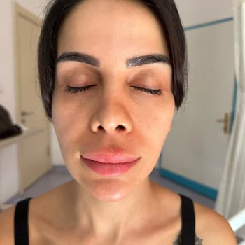 Özel Fatih Hastanesi'nde Burun Estetiklerini Pratisyen Hekim Yapıyor