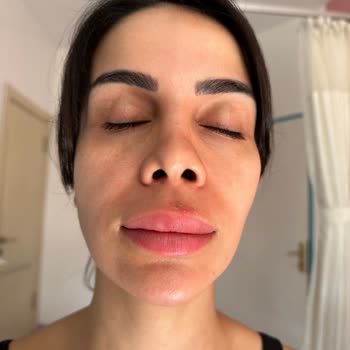 Özel Fatih Hastanesi'nde Burun Estetiklerini Pratisyen Hekim Yapıyor