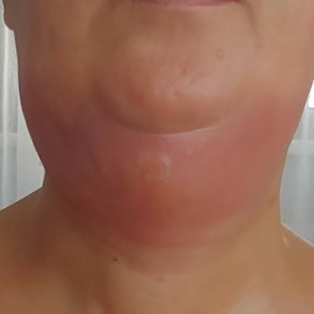 B7 Clinics Şikayeti