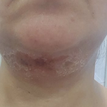 B7 Clinics Şikayeti