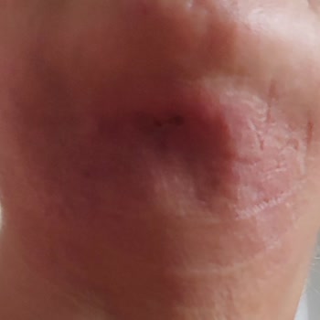 B7 Clinics Şikayeti