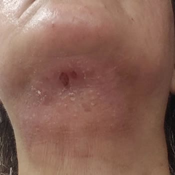 B7 Clinics Şikayeti