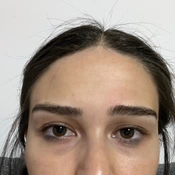 Dermaplus Klinik Yapılan İşlemler Sonucu Hayal Kırıklığı