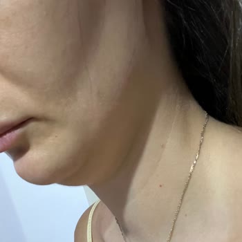 Dermaplus Klinik Yapılan İşlemler Sonucu Hayal Kırıklığı