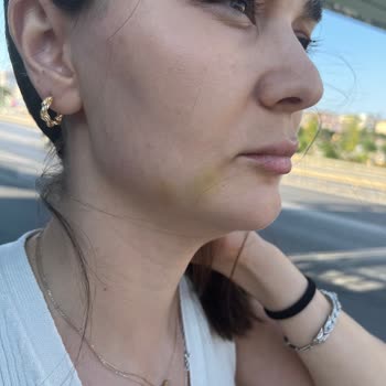 Dermaplus Klinik Yapılan İşlemler Sonucu Hayal Kırıklığı