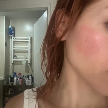 Loreal Paris Güneş Kremi Yüzümü Yaktı