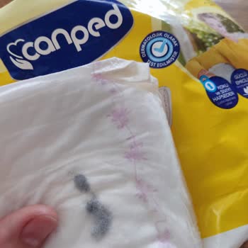 Canped Mesane Pedi İçinde Gömülü Siyah Madde