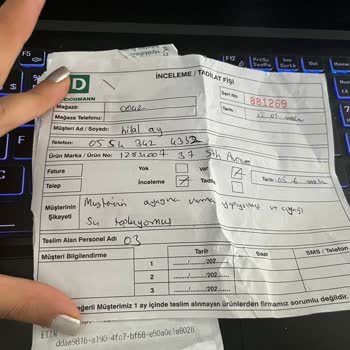Deichmann Terlik Ayağa Yara Yapması