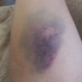 Manavgat Devlet Hastanesi Hasta Sağlığı İçin Risk Faktörleri!