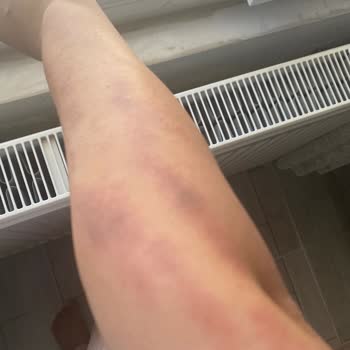 Golden Güzellik Kasıtlı Yaralama, İhmal Ve Çocuk Çalışanca Hizmet