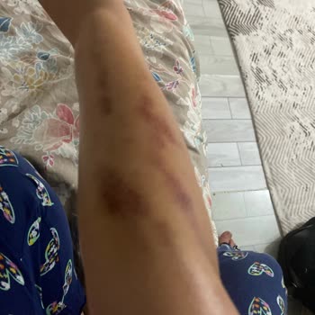 Golden Güzellik Kasıtlı Yaralama, İhmal Ve Çocuk Çalışanca Hizmet