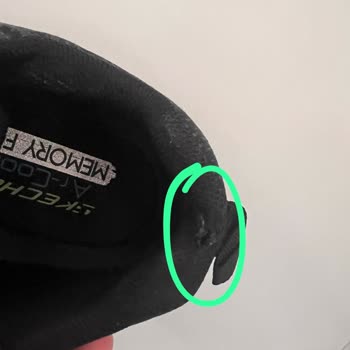 Skechers Ayakkabının Filesinde Açılma Problemi