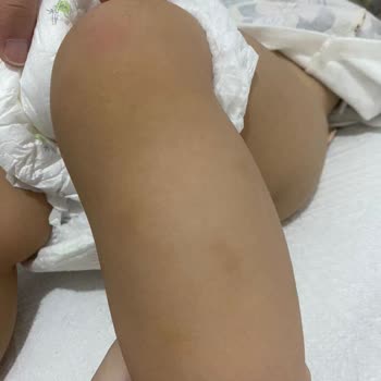 Düş Bahçesi Okulları Düş Bahçem Kreşi Şikayeti