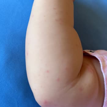 Organicum Bebekler İçin Güvenli Olmayan Organik Sinek Koruyucu Sprey