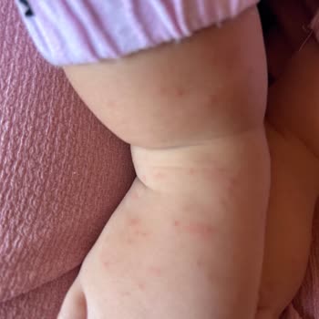 Organicum Bebekler İçin Güvenli Olmayan Organik Sinek Koruyucu Sprey