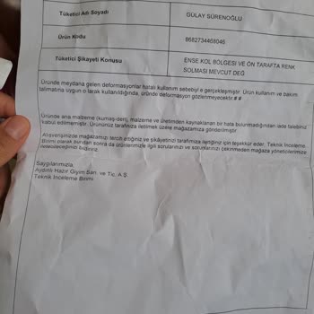 Us Polo Gömlek Sararma