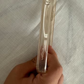 Spigen Türkiye Kılıfı Sarardı