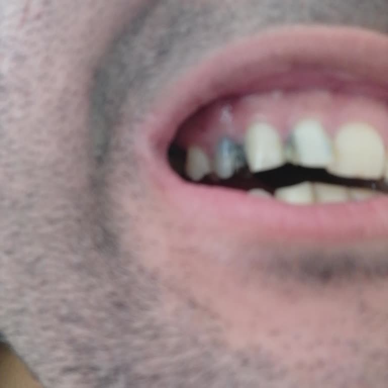 Çerkezköy Ağız ve Diş Sağlığı Merkezi Çerkezköy Ağız Ve Diş Sağlığı Hastanesi Kanal Tedavisi