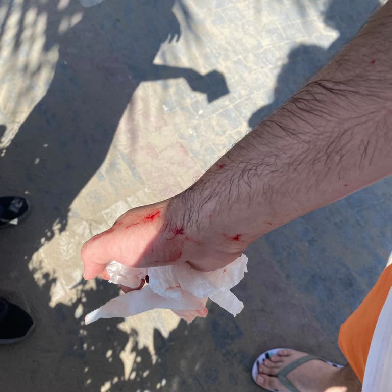 Limon Ağacı Restaurant Kafamıza Bardak Fırlatıldı