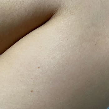 Braun Kişisel Bakım Ürünleri Braun Silk Expert Pro 5 Lazer Cihazı Leke Yaptı