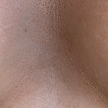 Braun Kişisel Bakım Ürünleri Braun Silk Expert Pro 5 Lazer Cihazı Leke Yaptı