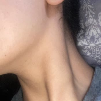 Braun Kişisel Bakım Ürünleri Braun Silk Expert Pro 5 Lazer Cihazı Leke Yaptı