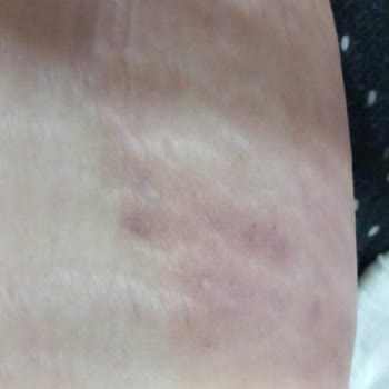 Gökçen Gökçe (GOP) Müşteri Memnuniyeti 0