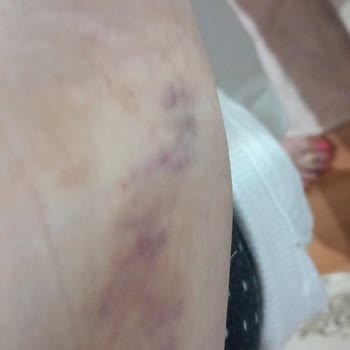 Gökçen Gökçe (GOP) Müşteri Memnuniyeti 0