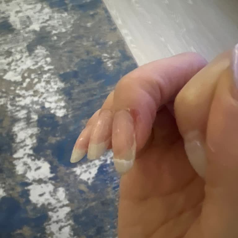 Rossmann Son Kullanma Tarihi Geçmiş Ürün Gönderimi