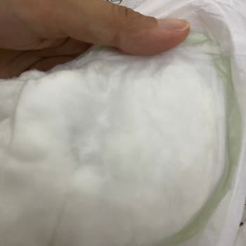 Önlem Çocuk Bezi Önlem Botanika Bebek Bezi