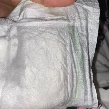 Önlem Çocuk Bezi Önlem Botanika Bebek Bezi