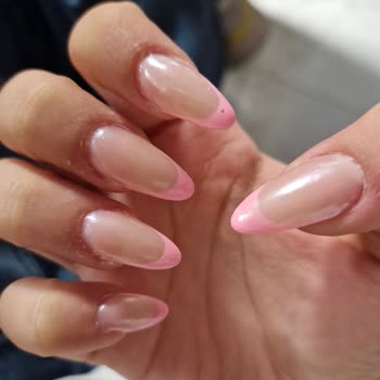 Protez Tırnak Çınare Hatalarını Kabul Etmeyip Azarladılar