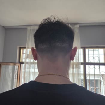 Estecenter Saç Ekimi Şikayet