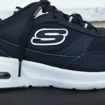 Skechers Ayakkabılarında Beklenmedik Sorunlar