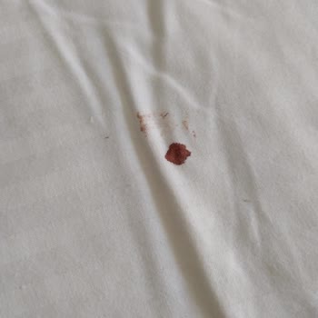 Club Nena Otel 5 Yıldızlı Gibi Değil!