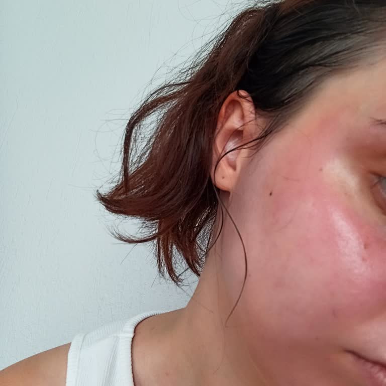 Garnier Ciltte Tahriş Yapan Yüz Temizleme Jeli