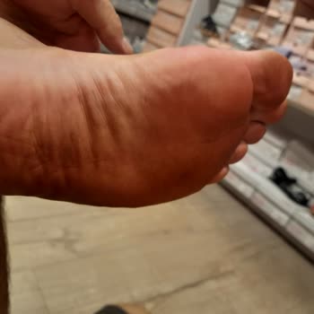 Deichmann Sandalet Ayaklarımı Boyadı Çok Kaliteli