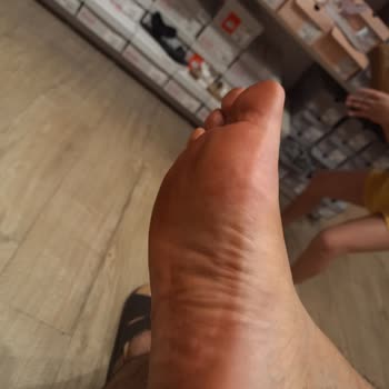 Deichmann Sandalet Ayaklarımı Boyadı Çok Kaliteli