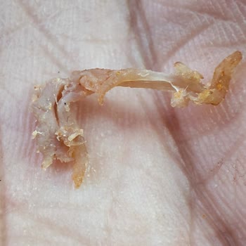 Köfteci Yusuf Köfteden Çıkan Madde