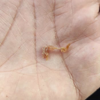 Köfteci Yusuf Köfteden Çıkan Madde