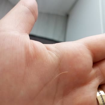 Hipp Yabancı Madde Çıktı