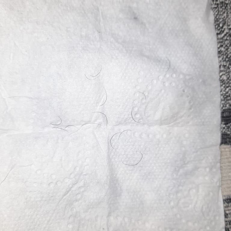 Bursa Demirtaş Green Life Güzellik Merkezi Şikayeti