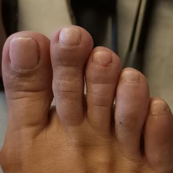 Zarina Beauty Center Pedikür Kalıcı Oje Hüsranı!