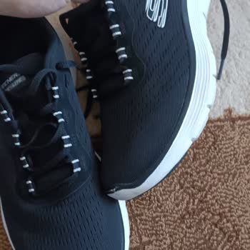 Skechers Soyulma Ve Markanın Ayakkabının Arkasında Duramaması
