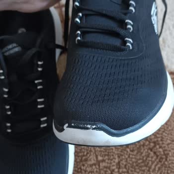 Skechers Soyulma Ve Markanın Ayakkabının Arkasında Duramaması