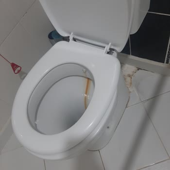 Özel Kemal Bayındır Hastanesi Gaziantep'te En Kötüsü